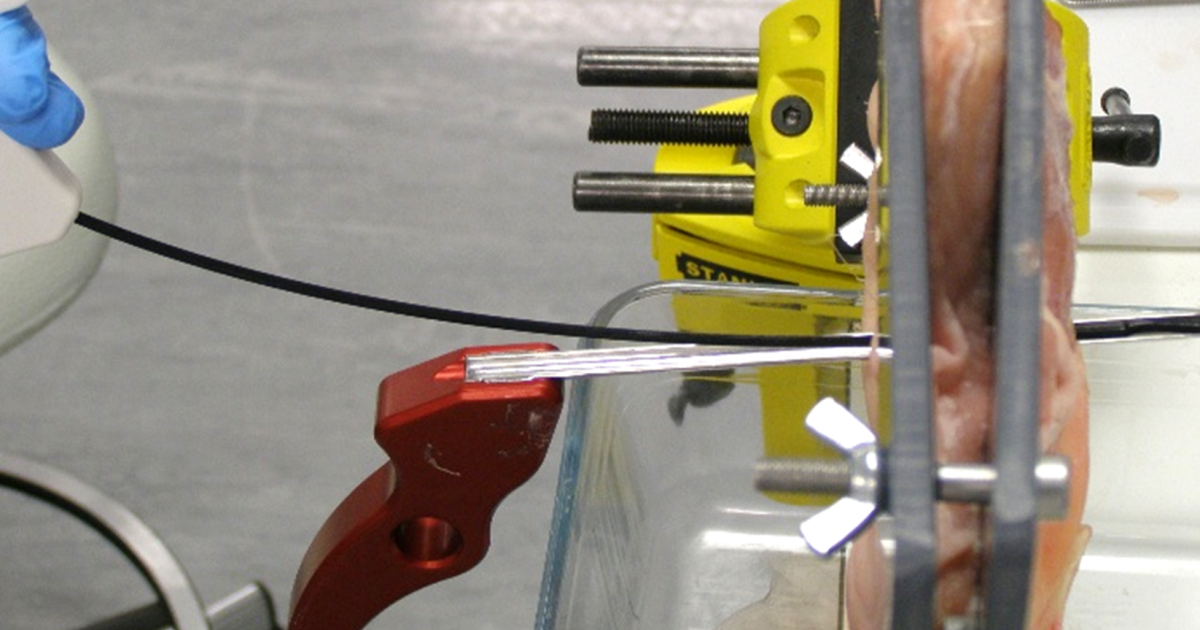 Built to Bend: Articulating RF Device Design | ATL Medical